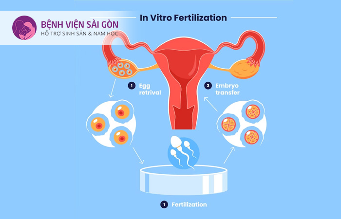 IVF là phương pháp thụ tinh trong ống nghiệm