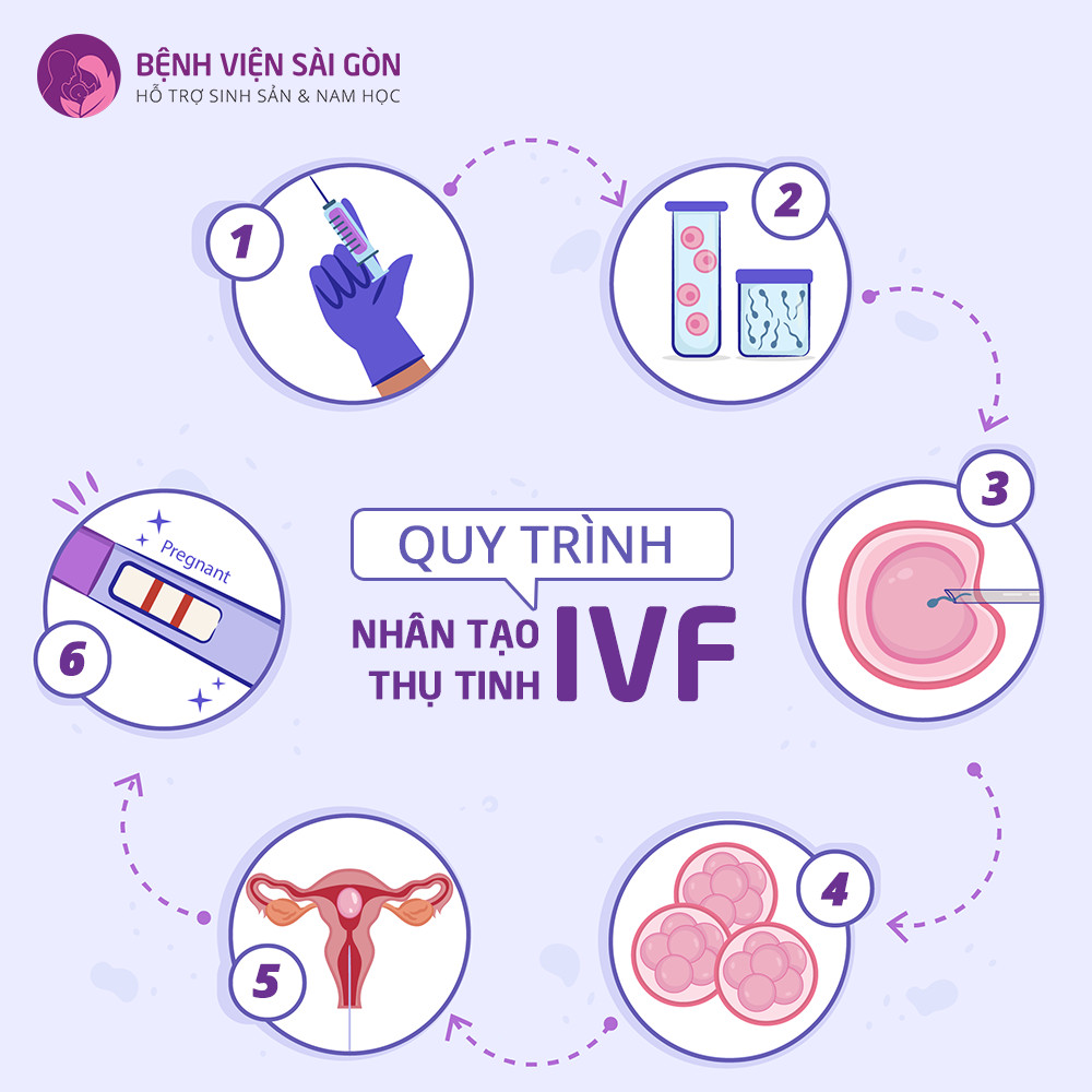 Quy trình thụ tinh trong ống nghiệm (IVF) gồm bao nhiêu bước?